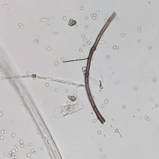 Microscope view of a fungal strand in BioSoil